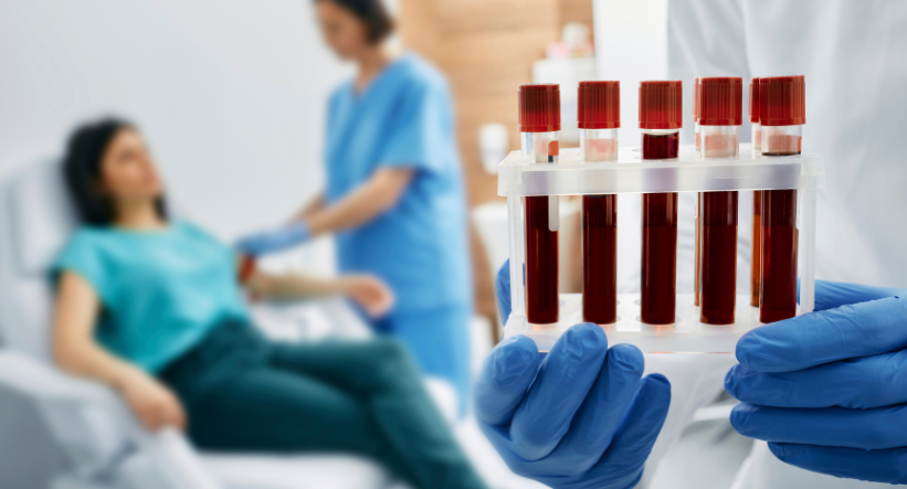 TOP 5 razloga zašto svake godine trebate izvaditi kompletnu krvnu sliku
